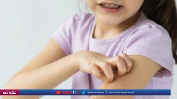 10 soruda kış alerjileri
