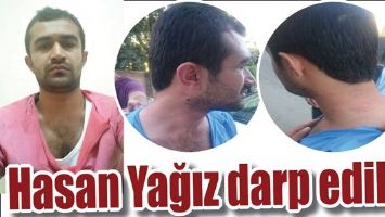 HASAN YAĞIZ DARP EDİLDİ