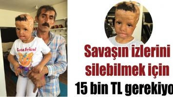 Savaşın izlerini silebilmek i&ccedil;in 15 bin TL gerekiyor