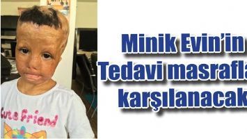 Minik Evin&rsquo;in tedavi masrafları karşılanacak