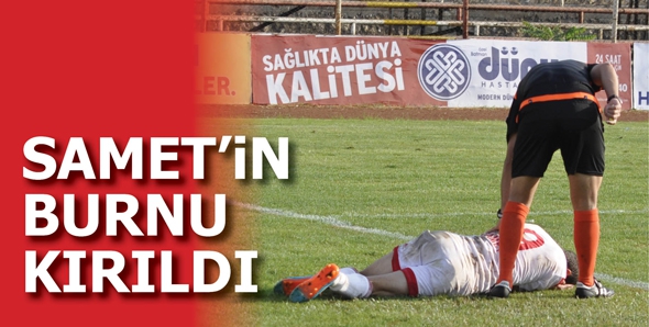SAMET&rsquo;İN BURNU KIRILDI