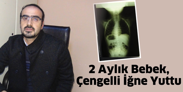 2 AYLIK BEBEK, &Ccedil;ENGELLİ İĞNE YUTTU