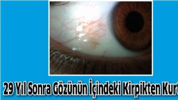 29 YIL SONRA G&Ouml;Z&Uuml;N&Uuml;N İ&Ccedil;İNDEKİ KİRPİKTEN KURTULDU