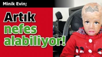 ARTIK NEFES ALABİLİYOR