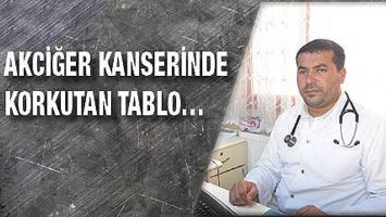 AKCİĞER KANSERİNDE KORKUTAN TABLO&hellip;