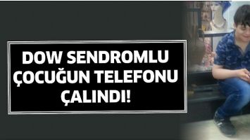 DOW SENDROMLU &Ccedil;OCUĞUN TELEFONU &Ccedil;ALINDI!