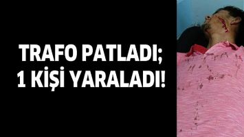 TRAFO PATLADI; 1 KİŞİ YARALADI!