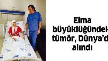 ELMA B&Uuml;Y&Uuml;KL&Uuml;Ğ&Uuml;NDEKİ T&Uuml;M&Ouml;R, D&Uuml;NYA&rsquo;DA ALINDI