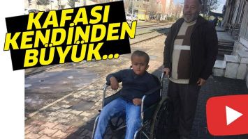 KAFASI KENDİNDEN B&Uuml;Y&Uuml;K&hellip;