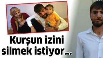 KURŞUN İZİNİ SİLMEK İSTİYOR&hellip;