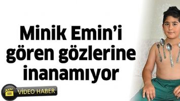 MİNİK EMİN&rsquo;İ G&Ouml;REN G&Ouml;ZLERİNE İNANAMIYOR