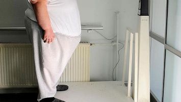 2,5 milyon kişi, obezite cerrahisiyle tedavi edilebilir