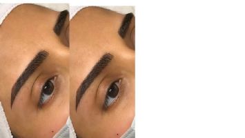Mucize, microbladinge başladı