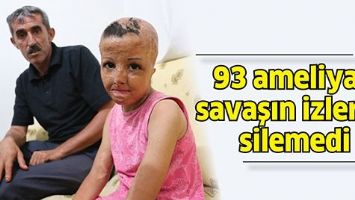 93 AMELİYAT, SAVAŞIN İZLERİNİ SİLEMEDİ