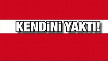 KENDİNİ YAKTI!...