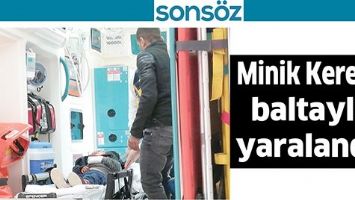 MİNİK KEREM, BALTAYLA YARALANDI!