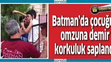BATMAN'DA &Ccedil;OCUĞUN OMZUNA DEMİR KORKULUK SAPLANDI