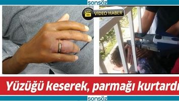 Y&Uuml;Z&Uuml;Ğ&Uuml; KESEREK, PARMAĞI KURTARDILAR