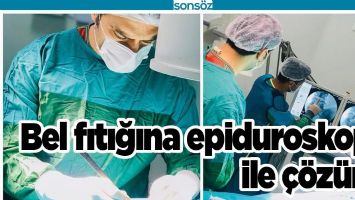 BEL FITIĞINA EPİDUROSKOPİ İLE &Ccedil;&Ouml;Z&Uuml;M