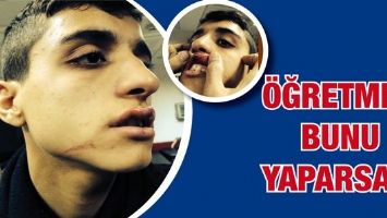 &Ouml;ĞRETMEN BUNU YAPARSA?