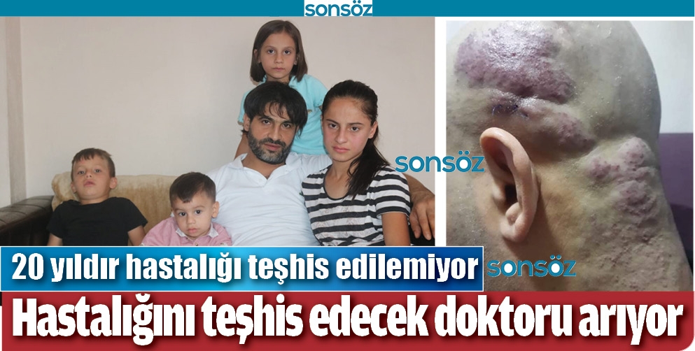 HASTALIĞINI TEŞHİS EDECEK DOKTORU ARIYOR