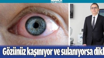 G&Ouml;Z&Uuml;N&Uuml;Z KAŞINIYOR VE SULANIYORSA DİKKAT!