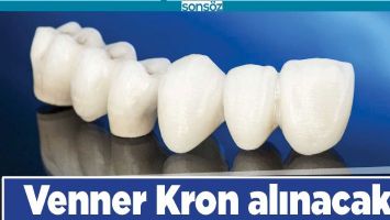 VENNER KRON ALINACAK