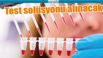 TEST SOL&Uuml;SYONU ALINACAK