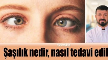 ŞAŞILIK NEDİR, NASIL TEDAVİ EDİLİR?