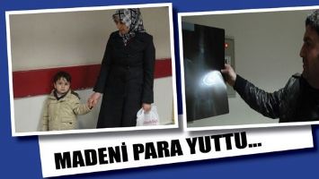 MADENİ PARA YUTTU...