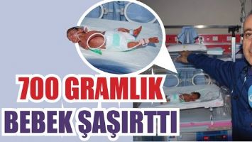 700 GRAMLIK BEBEK ŞAŞIRTTI