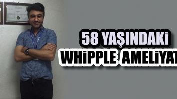 58 YAŞINDAKİ WHİPPLE AMELİYATI!