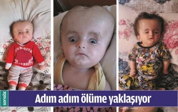 ADIM ADIM &Ouml;L&Uuml;ME YAKLAŞIYOR