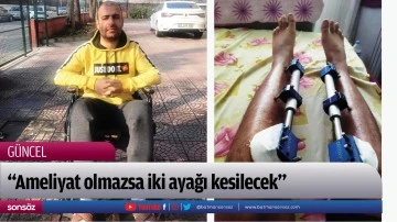 &ldquo;Ameliyat olmazsa iki ayağı kesilecek&rdquo;