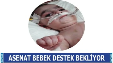 Asenat Bebek destek bekliyor