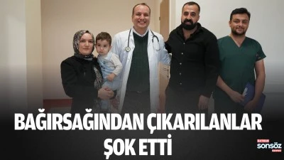 Bağırsağından &ccedil;ıkarılanlar şok etti