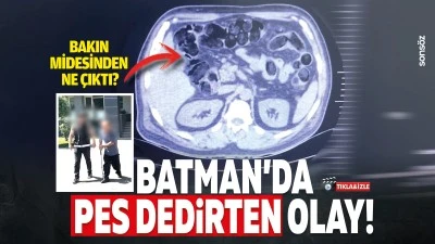 Batman&rsquo;da pes dedirten olay! Bakın midesinden ne &ccedil;ıktı?