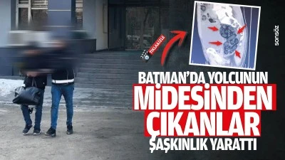 Batman&rsquo;da yolcunun midesinden &ccedil;ıkanlar şaşkınlık yarattı