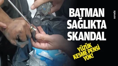 Batman sağlıkta skandal: Y&uuml;z&uuml;k kesme pensi yok!