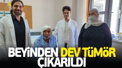 Beyinden dev t&uuml;m&ouml;r &ccedil;ıkarıldı