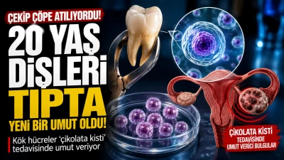 &Ccedil;ekilip &Ccedil;&ouml;pe Atılan 20 Yaş Dişleri Tıpta Umut Oldu