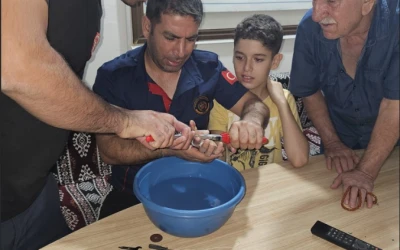 &Ccedil;ocuğun parmağı sıkıştığı vida pulundan &ccedil;ıkartıldı
