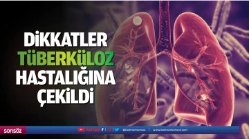 Dikkatler t&uuml;berk&uuml;loz hastalığına &ccedil;ekildi