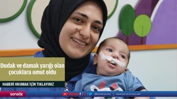 Dudak ve damak yarığı olan &ccedil;ocuklara umut oldu