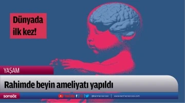 D&uuml;nyada ilk kez!