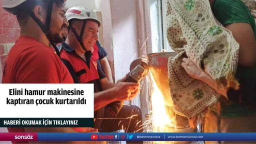 Elini hamur makinesine kaptıran &ccedil;ocuk kurtarıldı