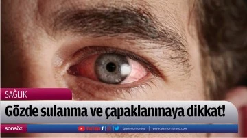 G&ouml;zde sulanma ve &ccedil;apaklanmaya dikkat!