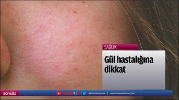 G&uuml;l hastalığına dikkat