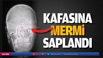Kafasına mermi saplandı