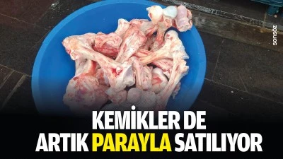 Kemikler de artık parayla satılıyor